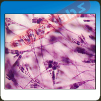 Penicillium w.m.